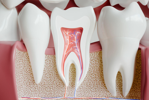 root canal