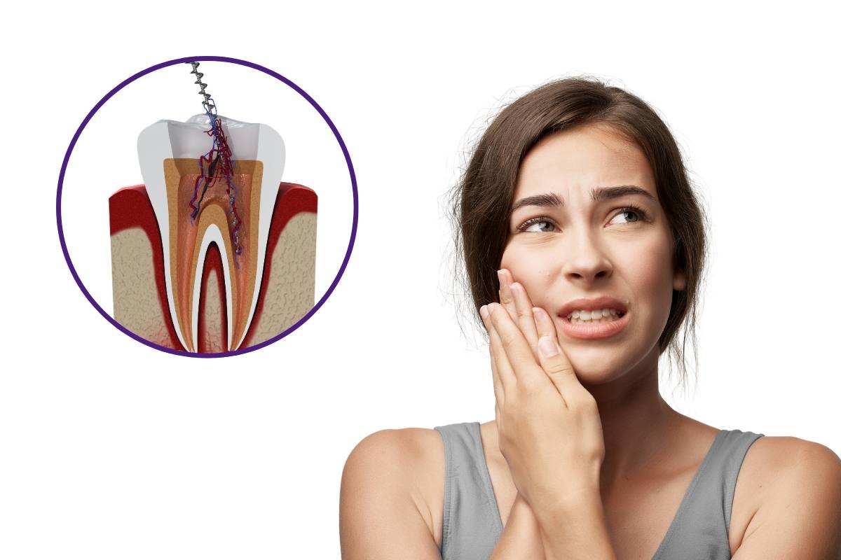 Root Canal Recovery Tips: