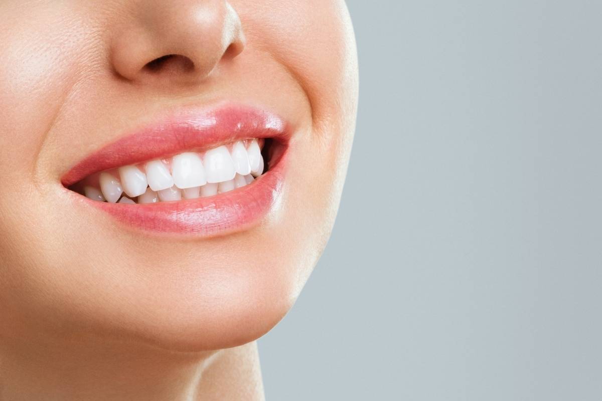 How long does teeth whitening last